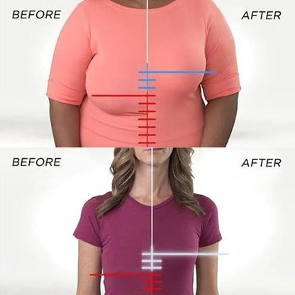Lyro™ | SoftSupport Bra